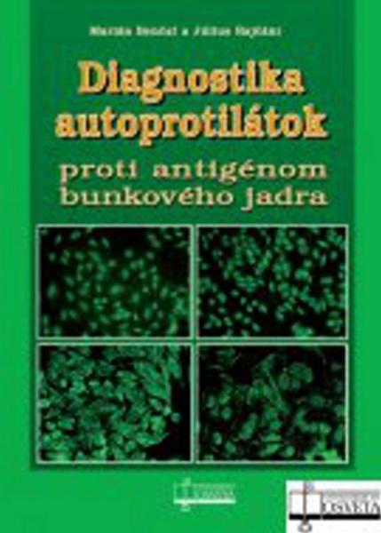 Levně Diagnostika autoprotilátok proti antigénom bunkového jadra
