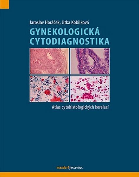 Gynekologická cytodiagnostika - 978-80-7345-327-5