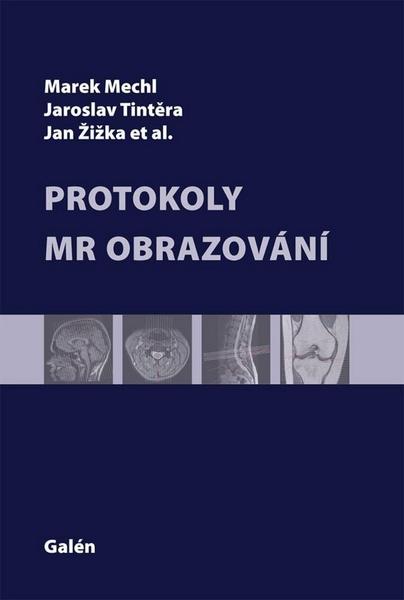 Protokoly v MR zobrazování - 978-80-7492-109-4