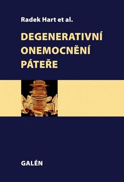 Degenerativní onemocnění páteře - 978-80-7492-067-7