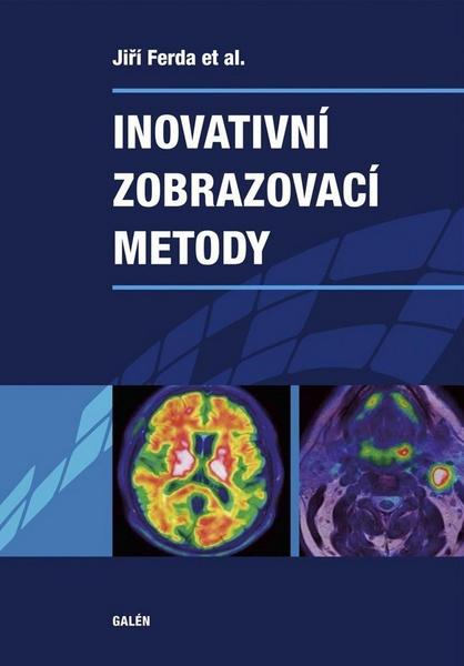 Levně Inovativní zobrazovací metody