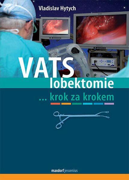 Levně VATS lobektomie