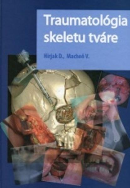 Traumatológia skeletu tváre - 978-80-971444-0-1