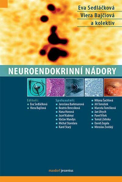 Levně Neuroendokrinní nádory