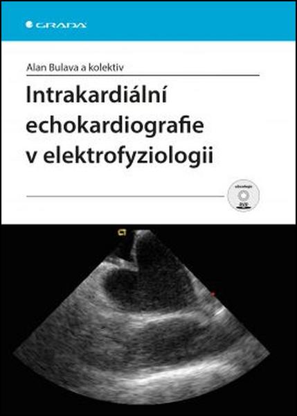 Intrakardiální echokardiografie v elektrofyziologii - 978-80-247-5482-6