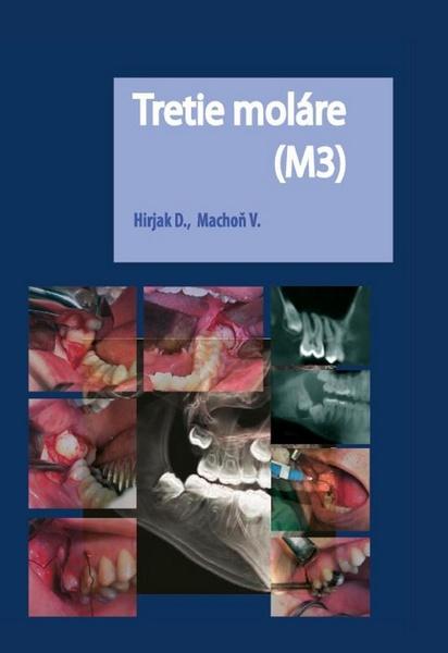 Levně Tretie moláre (M3)