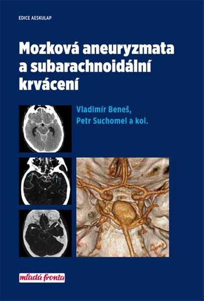 Mozková aneurysmata a subarachnoidální krvácení - 978-80-204-4406-6