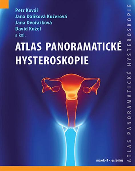 Atlas panoramatické hysteroskopie - 978-80-7345-542-2