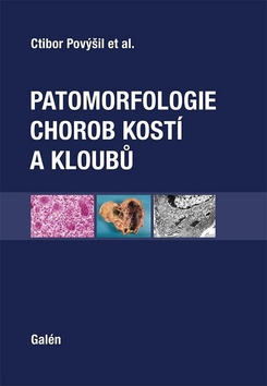 Levně Patomorfologie chorob kostí a kloubů