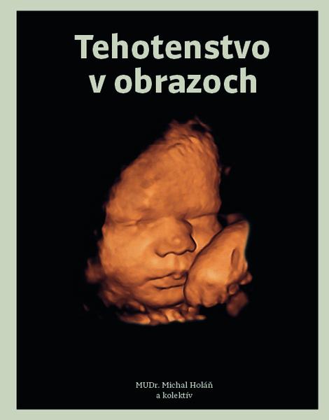 Tehotenstvo v obrazoch - 978-80-8142-708-4