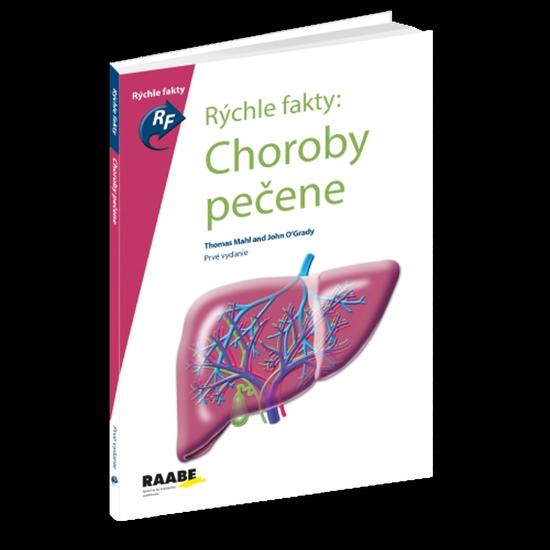 Levně Rýchle fakty: Choroby pečene