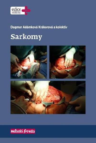 Sarkomy - 978-80-204-5271-9
