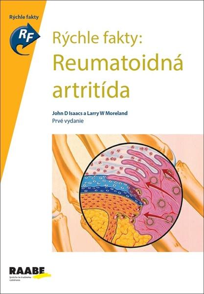 Rýchle fakty: Reumatoidná artritída - 978-80-8140-395-8