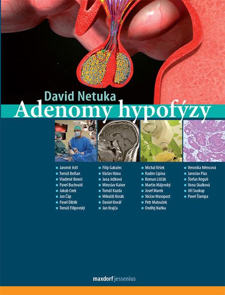 Adenomy hypofýzy - 978-80-7345-620-7