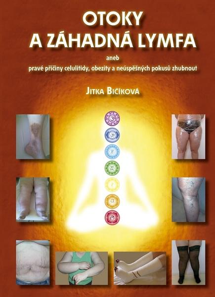 Otoky a záhadná lymfa - 978-80-270-3843-5