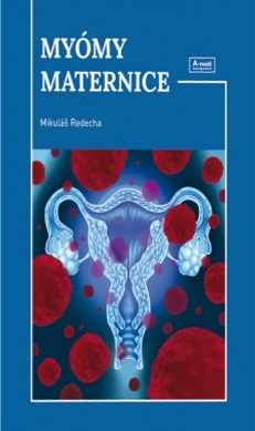 Myómy maternice - 978-80-89797-50-9
