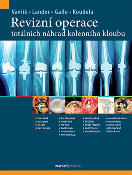 Levně Revizní operace totálních náhrad kolenního kloubu
