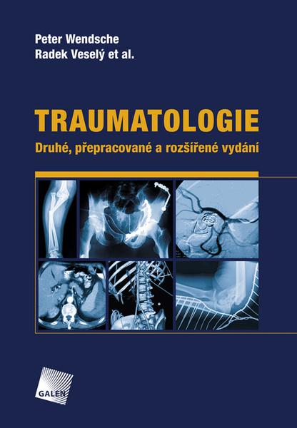 Traumatologie - 978-80-7492-452-1