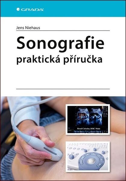 Levně Sonografie Praktická příručka