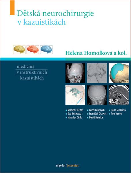 Levně Dětská neurochirurgie v kazuistikách