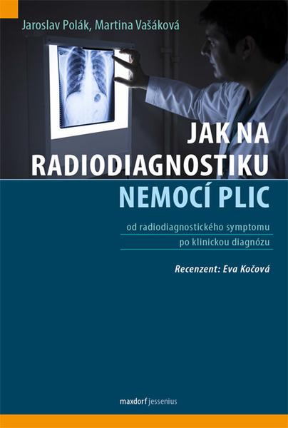 Levně Jak na radiodiagnostiku nemocí plic