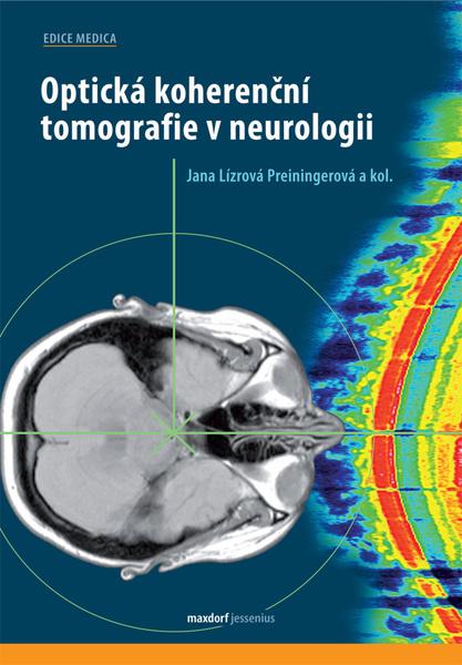 Levně Optická koherenční tomografie v neurologii