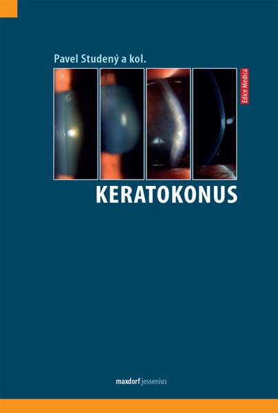 Levně Keratokonus