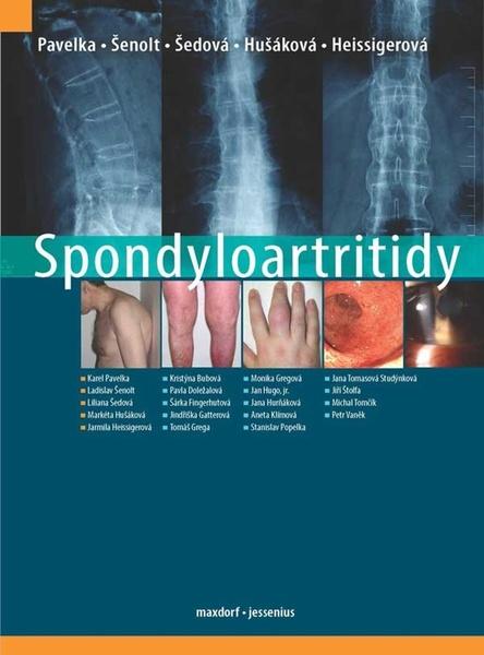Levně Spondyloartritidy - Karel Pavelka; Ladislav Šenolt; Liliana Šedová