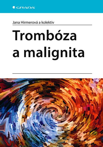Trombóza a malignita - 978-80-271-3051-1