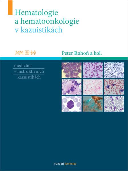 Levně Hematologie a hematoonkologie v kazuistikách