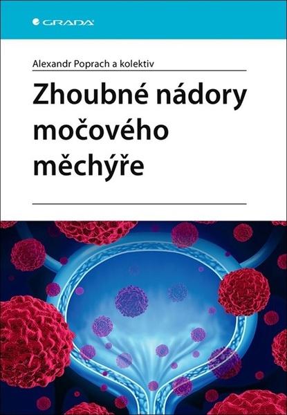 Zhoubné nádory močového měchýře - 978-80-271-2503-6