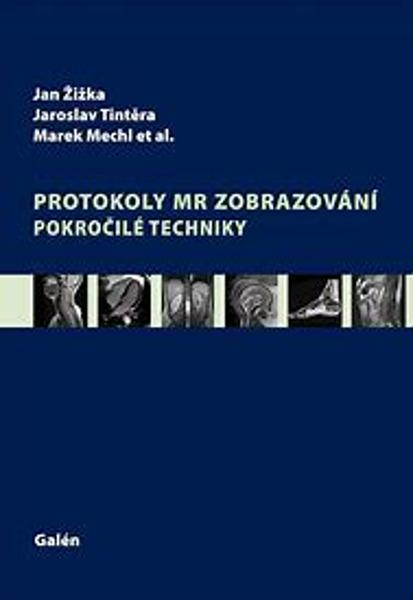 Protokoly v MR zobrazování - 978-80-7492-179-7