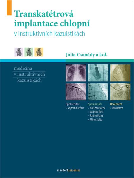 Levně Transkatétrová implantace chlopní v instruktivních kazuistikách