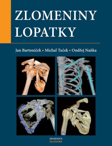 Levně Zlomeniny lopatky