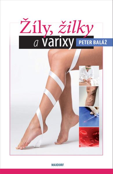 Levně Žíly, žilky, varixy