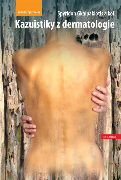Levně Kazuistiky z dermatologie