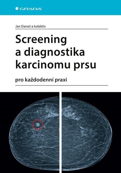 Screening a diagnostika karcinomu prsu - 978-80-271-1239-5