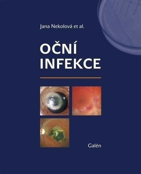 Oční infekce - 978-80-7492-514-6