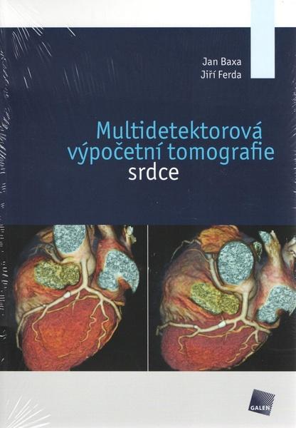 Multidetektorová výpočetní tomografie srdce - 9788072628803