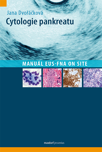 Cytologie pankreatu - 9788073453206