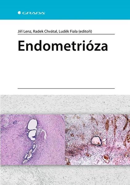 Endometrióza - 9788027130504