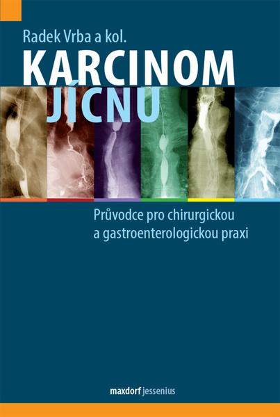 Levně Karcinom jícnu