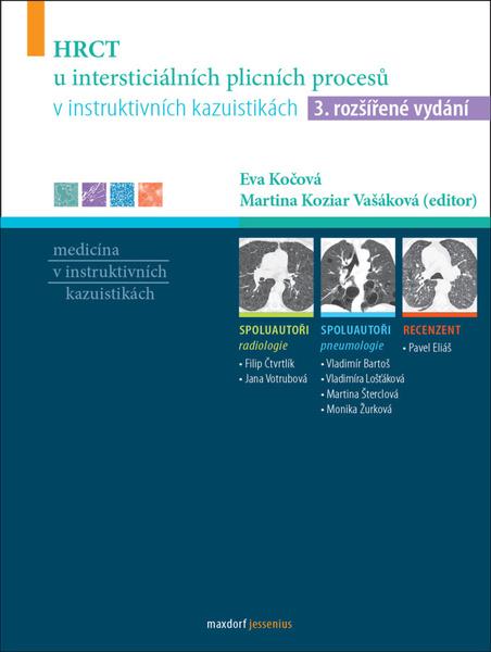 HRCT u intersticiálních plicních procesů v instruktivních kazuistikách - Kolektiv - 9788073457129