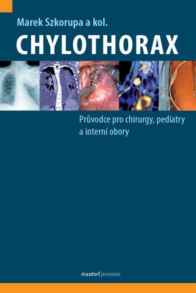 Levně Chylothorax