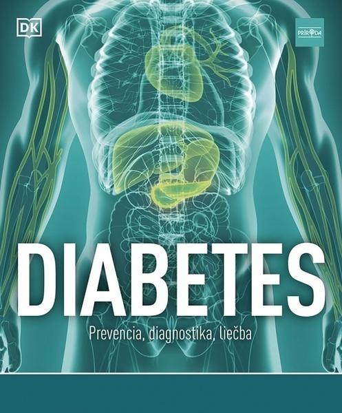 Diabetes Prevencia, diagnostika, liečba - 9788055181493
