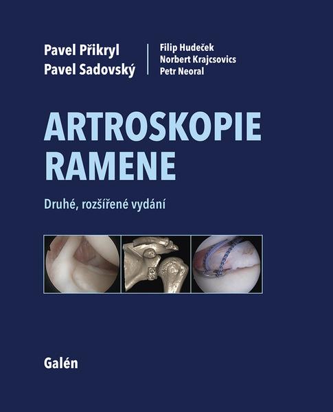 Artroskopie ramene - 9788074925801