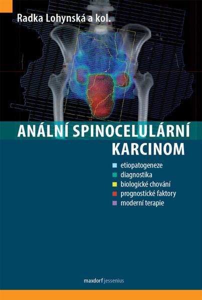 Levně Anální spinocelulární karcinom