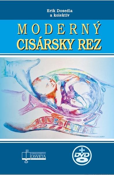 Levně Moderný cisársky rez