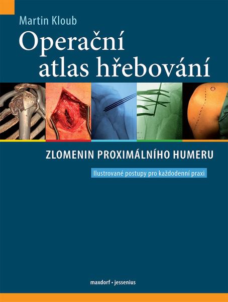 Levně Operační atlas hřebování zlomenin proximálního humeru