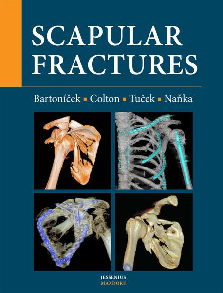 Levně Scapular fractures